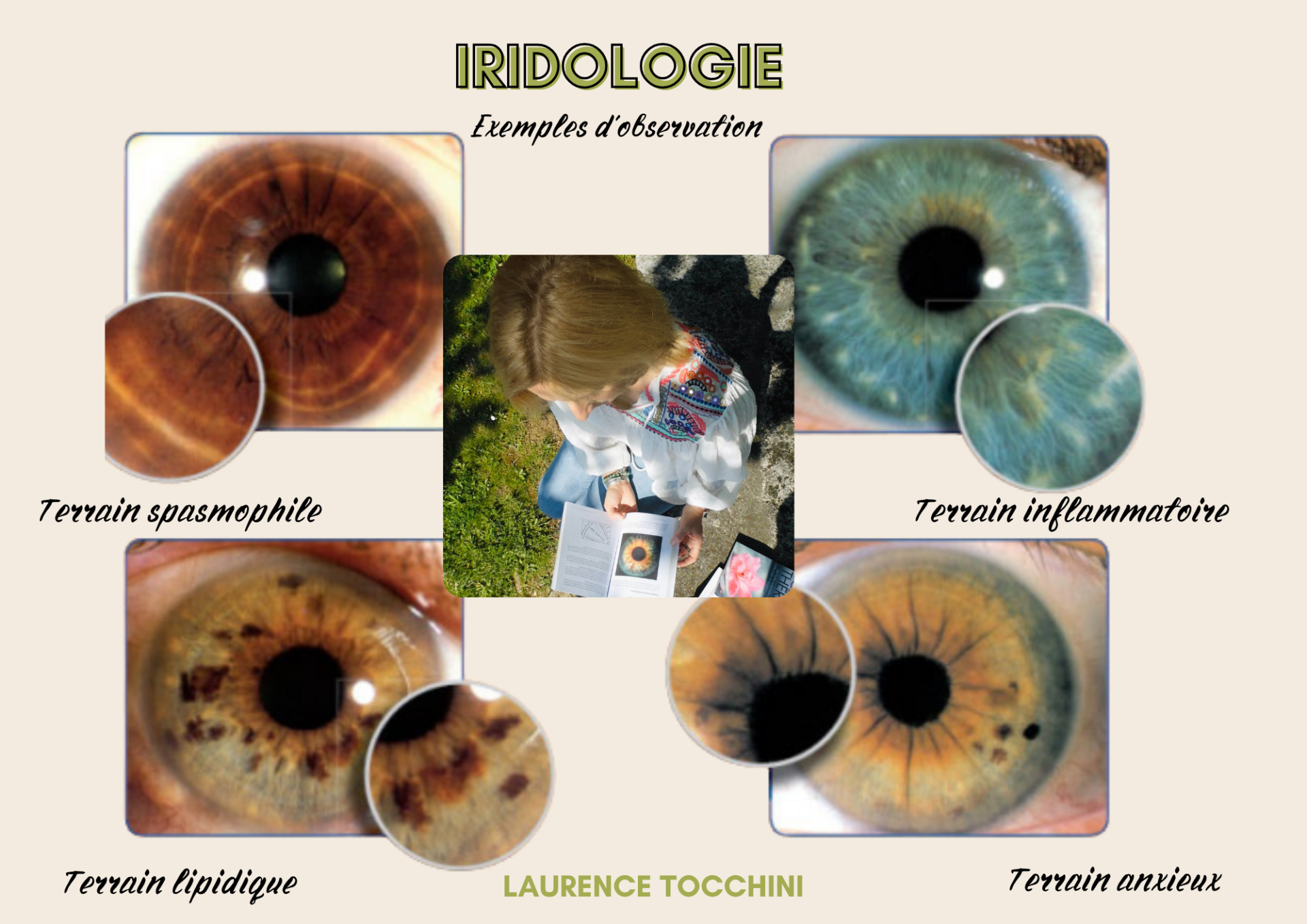 iridologie exemples